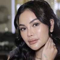 Nikita Mirzani Mawardi menjalani operasi plastik di Korea Selatan belum lama ini. Ada dua prosedur bedah kecantikan yang dilakukan untuk wajahnya. Foto: dok. Instagram Nikita Mirzani