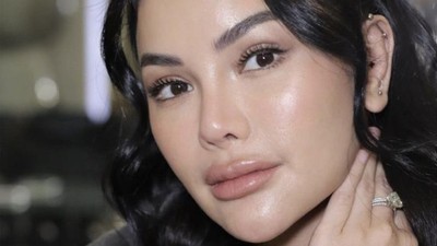 Nikita Mirzani Operasi Plastik di Korsel, Wajah Barunya Bikin Pangling
