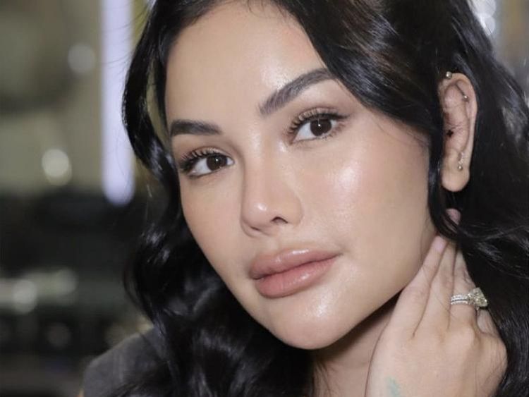 Nikita Mirzani Operasi Plastik di Korsel, Wajah Barunya Bikin Pangling