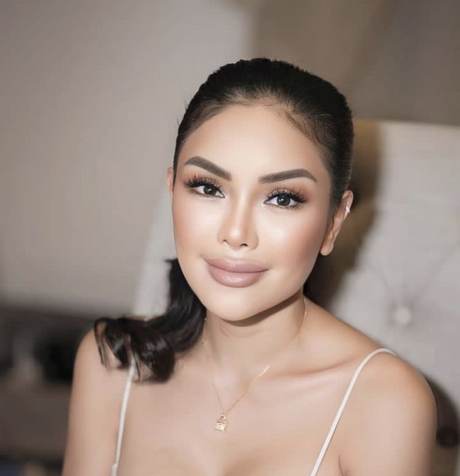 Selebriti kelahiran 1986 ini melakukan operasi plastik untuk bagian kelopak mata dan transfer lemak di bagian kening atau lipofilling. Penampilannya pun kini jauh berbeda dari sebelumnya, dan bikin pangling. Foto: dok. Instagram Nikita Mirzani