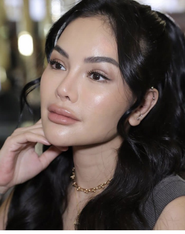 Nikita Mirzani Operasi Plastik Di Korsel Wajah Barunya Bikin Pangling