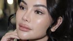Nikita Mirzani Operasi Plastik di Korsel, Wajah Barunya Bikin Pangling