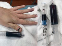 Viral Darah Wanita Berubah Jadi Biru Pasca Pakai Obat Sakit Gigi, Kok Bisa?