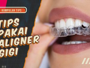 KuTips: Saran Dokter Rapikan Gigi Pakai Aligner