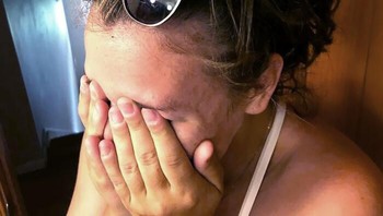 Ketika kaktus tidak bisa lepas dari rambut wanita ini. Foto: Boredpanda