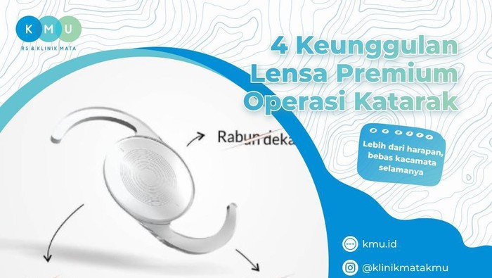 Operasi Premium Bisa Sembuhkan Katarak & Mata Minus Silinder
