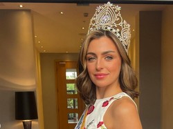 8 Potret Wanita Dulu Di-bully Hingga Anoreksia Kini Jadi Ratu Kecantikan