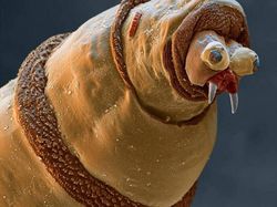 Foto Menyeramkan Hewan Saat Dilihat Pakai Mikroskop