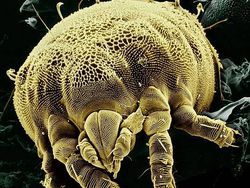 Foto Menyeramkan Hewan Saat Dilihat Pakai Mikroskop