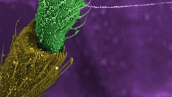 Struktur bagian dalam mata lalat. Foto: Allthatinteresting