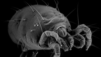 Ini adalah tungau. Foto: Allthatinteresting