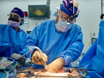 Tim Bedah di Boston Berhasil Transplantasi Ginjal Babi ke Manusia