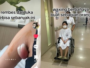 Awal Mula Wanita Harus Operasi Ketiak usai Waxing, Ketahuan Gegara Ini