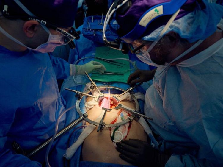 Detik-detik Ahli Bedah AS Sukses Cangkok Ginjal Babi ke Pasien Mati Otak