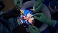 Eksperimen yang dilakukan NYU Langone Health merupakan ginjal babi terlama yang berfungsi pada manusia, meskipun resipiennya sudah meninggal. Peneliti bersiap melacak kinerja ginjal itu untuk bulan kedua. (Foto: Joe Carrotta / NYU Langone Health)