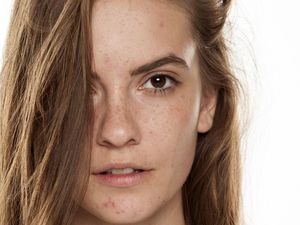 7 Cara Menghilangkan Bruntusan di Wajah, Pakai Skincare Bahan Ini