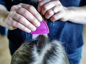 Dari Mana Munculnya Kutu Rambut pada Manusia?