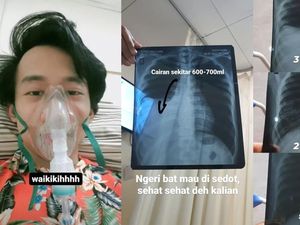 Viral Pengakuan Pria Jakarta Kapok Ngerokok, Penampakan Paru-parunya Jadi Begini