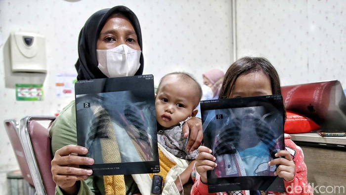 Dokter Paru Beberkan Efek Polusi Udara pada Anak, Bisa Picu Asma-ISPA