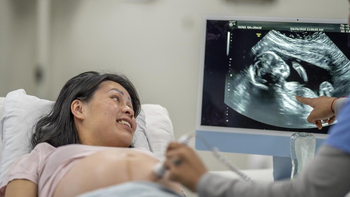 Cara Membaca Hasil USG yang Tepat dan Benar, Penting untuk Bumil