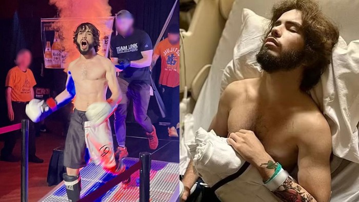 Atlet MMA alami masalah kesehatan karena vape hingga parunya diangkat sebelah.