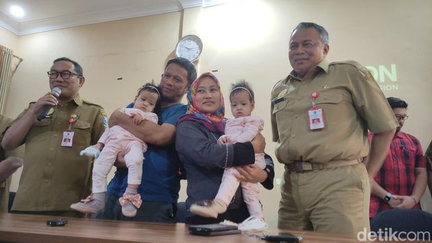 bayi kembar siam malang