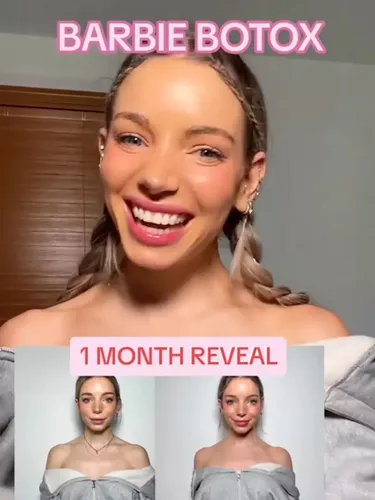 Isabelle Lux, influencer yang memopulerkan Barbie Botox.