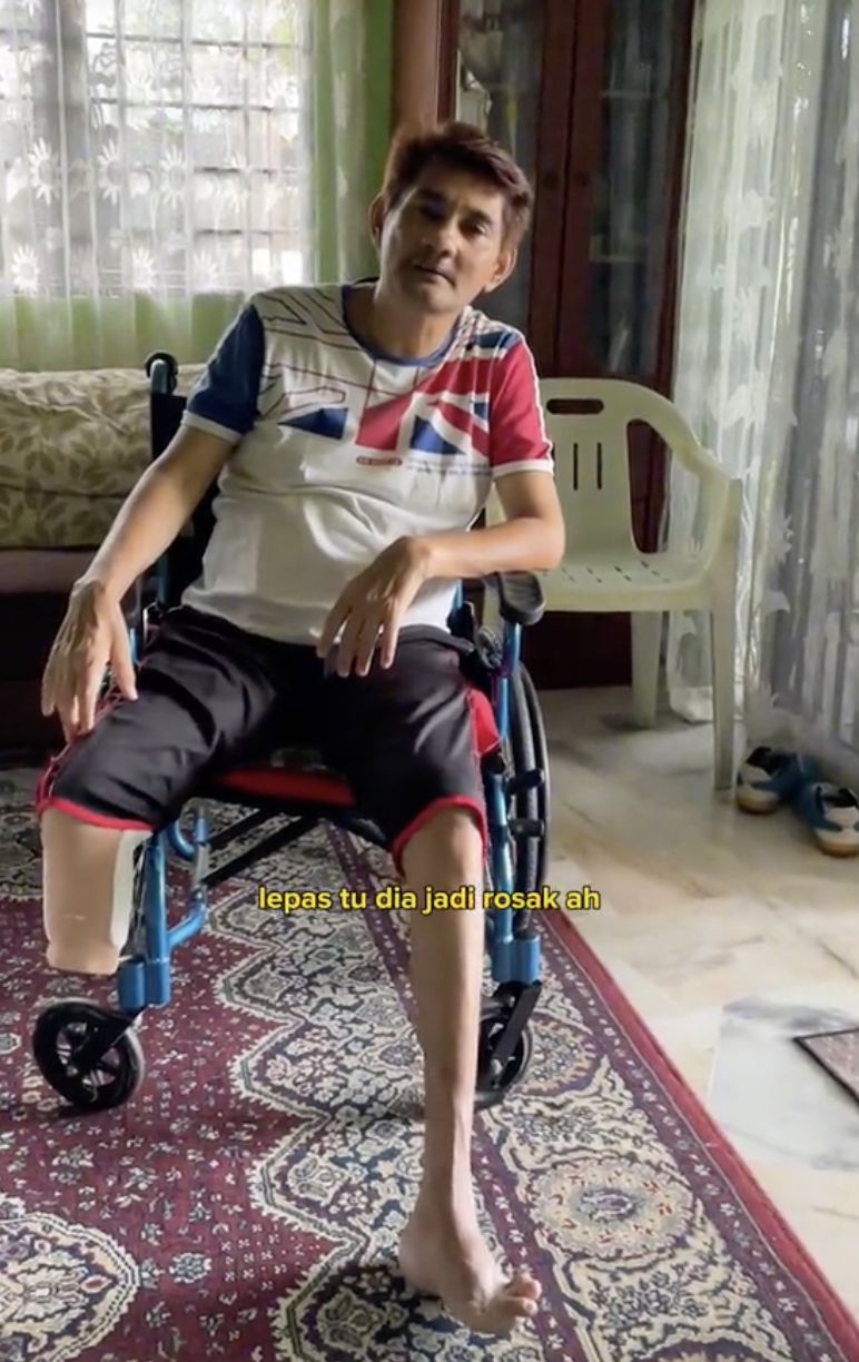 Minum 3 Gelas Teh Tarik Tiap Hari Selama 30 Tahun, Kaki Pria Ini Diamputasi!