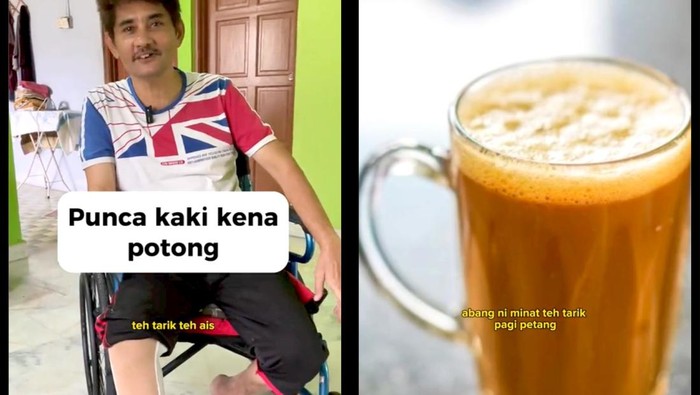 Viral Kisah Pria Diabetes Harus Amputasi Kaki, Berawal dari Doyan Minum Manis