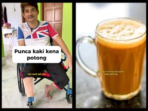 Kata Dokter soal Amputasi akibat Diabetes, Dikaitkan Kasus Pria Doyan Teh Tarik