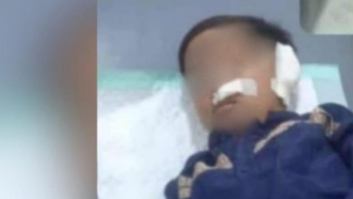 telinga bocah kota pasuruan putus digigit teman