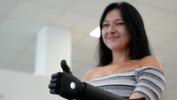 Orthopaedic technician Mike Unmacht of medical supplies company Lammert Scherer holds the bionic arm for Dominika Frycz, who received her new Open Bionics arm, among the first of its kind funded through health insurance and created with 3d printing, in Mainz, Germany, August 18, 2023. The 25-year-old who was born without a lower left arm had a bionic arm in the past, but decided against it because the weight of the arm and very limited movement caused more problems than it solved.  REUTERS/Max Schwarz
