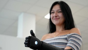 Lengan bionik ini didanai melalui asuransi kesehatan dan dibuat dengan pencetakan 3D.  