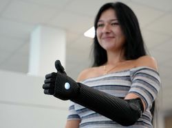 Wow! Lengan Bionik Hasil Cetak 3D Ini Sangat Luwes