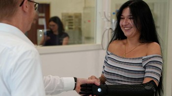 Lengan bionik terbaru ini mendapat respon positif dari pengguna lantaran lebih luwes.  