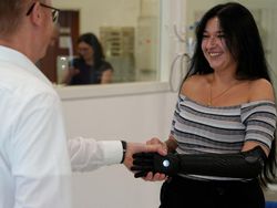 Wow! Lengan Bionik Hasil Cetak 3D Ini Sangat Luwes