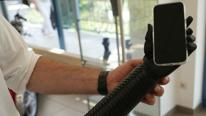 Orthopaedic technician Mike Unmacht of medical supplies company Lammert Scherer holds the bionic arm for Dominika Frycz, who received her new Open Bionics arm, among the first of its kind funded through health insurance and created with 3d printing, in Mainz, Germany, August 18, 2023. The 25-year-old who was born without a lower left arm had a bionic arm in the past, but decided against it because the weight of the arm and very limited movement caused more problems than it solved.  REUTERS/Max Schwarz