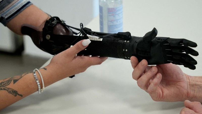 Orthopaedic technician Mike Unmacht of medical supplies company Lammert Scherer holds the bionic arm for Dominika Frycz, who received her new Open Bionics arm, among the first of its kind funded through health insurance and created with 3d printing, in Mainz, Germany, August 18, 2023. The 25-year-old who was born without a lower left arm had a bionic arm in the past, but decided against it because the weight of the arm and very limited movement caused more problems than it solved.  REUTERS/Max Schwarz