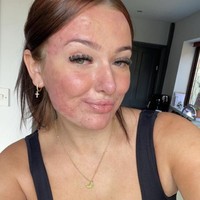 Berbagi kerentanannya di dunia maya telah membuatnya mendapatkan pengikut dalam jumlah besar sebanyak 996.000 pengikut di TikTok. Para penderita jerawat berbondong-bondong mengunjungi bagian komentarnya untuk memuji transparansinya, sementara yang lain meminta nasihat. Foto: Dok. Instagram/@courtneyjones02