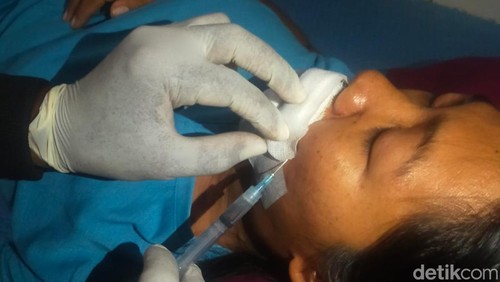 Satu dari tiga anggota keluaga yang digigit anjing rabies di Gianyar, Bali.