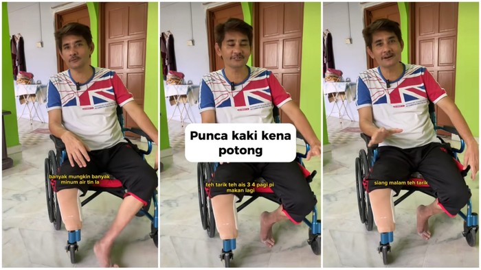 Kaki diamputasi karena diabetes