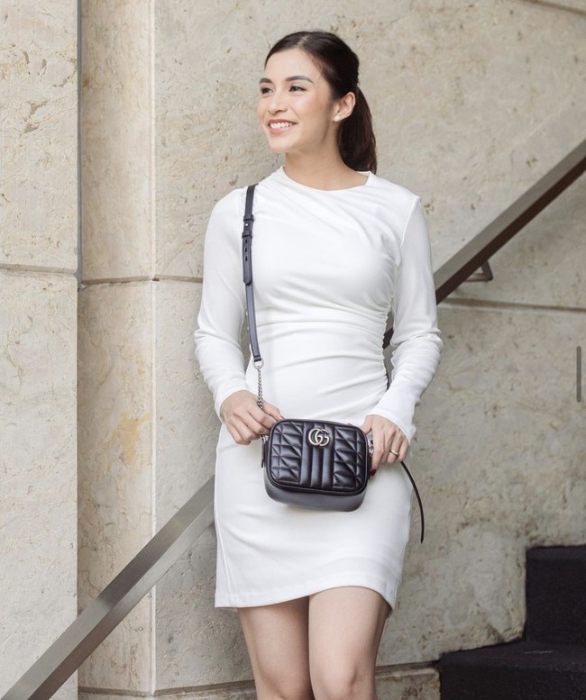 Istri Glenn Alinskie itu bercerita di Instagram sedang melakukan proses pelepasan gigi gingsul. Dengan berbagai perawatan invisalign, kemungkinan akan selesai pada 2024 mendatang. Foto: Instagram @chelseaoliviaa 