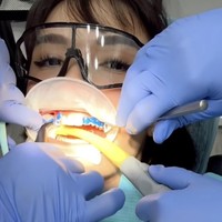 Perawatan giginya dimulai pada Juni 2023 dan kini masih dalam proses. Banyak netizen yang menyayangkan keputusan melepas gigi gingsul. Foto: Instagram @chelseaoliviaa