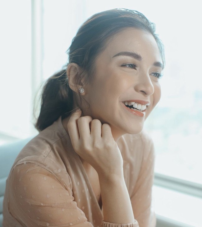 Saat tersenyum, Chelsea Olivia selalu cantik ‘ditemani’ gigi gingsulnya. Meski berat untuk melepas gigi gingsul namun banyak pula netizen yang mendukung keputusannya. Foto: Instagram @chelseaoliviaa