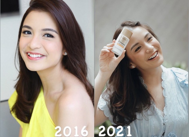 Sementara itu, mari melihat kembali gaya Chelsea Olivia saat masih tampil dengan gigi gingsul. Sungguh gigi gingsul mempermanis penampilannya dan tentu mencuri atensi. Foto: Instagram @chelseaoliviaa