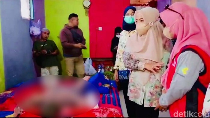 Azha (13) warga RT 02, RW 10 Desa Sukareja, Kecamatan Warureja, Kabupaten Tegal, Jawa Tengah, yang kulit di sekujur tubuhnya kering dan mengelupas. Foto diunggah pada Kamis (31/8/2023).