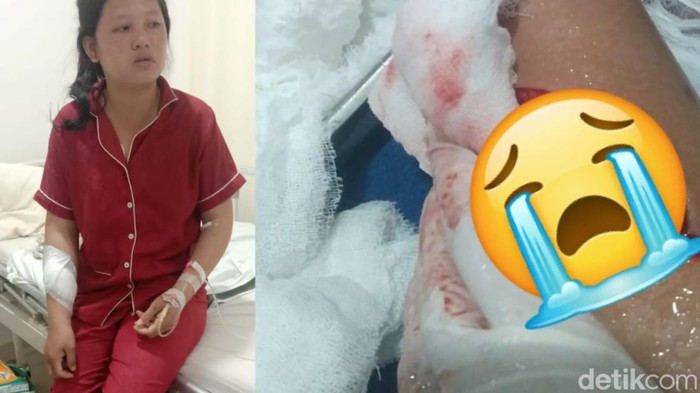 Yunita, emak-emak strong korban begal. Ia melawan pelaku hingga tangannya robek menganga.