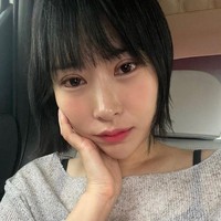 Dalam postingan terbaru di Instagram, pemain Wang Ja Hyun dalam Reply 1988 tersebut tak ragu membagikan potretnya setelah operasi mata. Dalam foto terlihat jelas bekas operasinya yang masih bengkak. Foto: Instagram