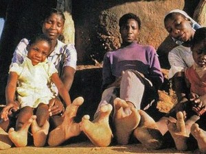 Fakta-fakta Seputar Suku Vadoma di Afrika dengan Kaki Burung Unta