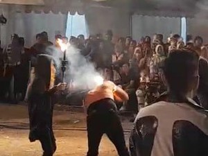 Limbad Dioperasi akibat Jenggot Terbakar Saat Atraksi Sembur Api di Madiun